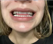 Purely White Deluxe Customer Reviews 1